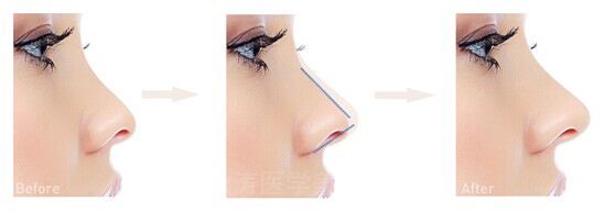 2023北京優(yōu)秀口腔醫(yī)院排行榜：協(xié)和、同仁再獲口碑認可！實力可信賴！