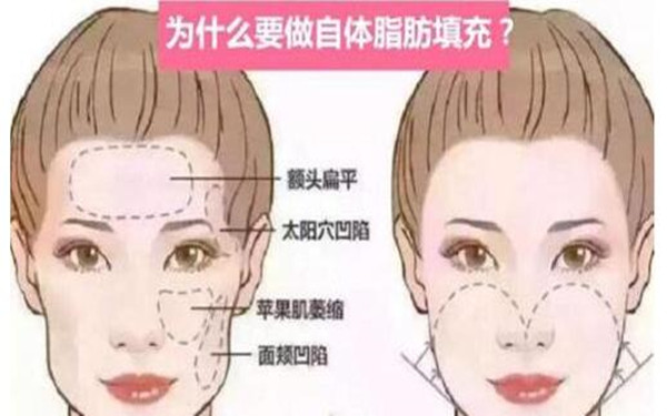 2023全國(guó)頜面整形醫(yī)生排名榜單發(fā)布！這些專家醫(yī)生值得關(guān)注