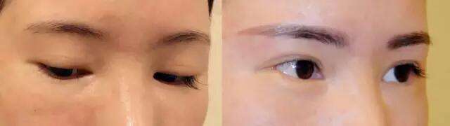 2023年上海好口碑的種植牙醫(yī)院推薦！看看這幾家醫(yī)院的技術如何！