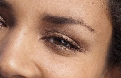 2023山西省脫疤權(quán)威醫(yī)院匯總 Top5，低價(jià)高效無(wú)憂祛疤！