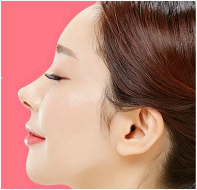 溫州點(diǎn)陣激光祛頸脖紋醫(yī)生