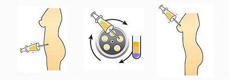 2023年廈門鼻部整形醫(yī)生推薦名單前7位露臉