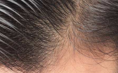 2023年棗莊去眼袋醫(yī)院排行榜最新整理，公立醫(yī)院與私立醫(yī)院綜合評(píng)價(jià)對(duì)比!