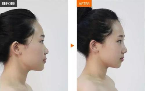 2023年成都做鼻部整形手術(shù)的專家名單公布，了解最可靠的整形醫(yī)生！