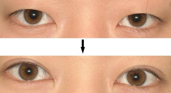 2023年天津口腔醫(yī)院正畸療效排名搶眼，悄然成為人們熱議話題的前5家推薦！