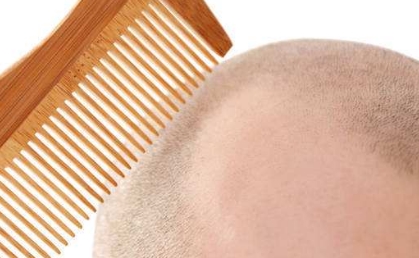 2023年南京口腔矯正醫(yī)院排行榜公布！這三家醫(yī)院上榜了！