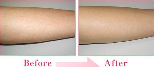 2023年成都脂肪抽吸手術(shù)頂級醫(yī)院盤點！這五家技能超群！