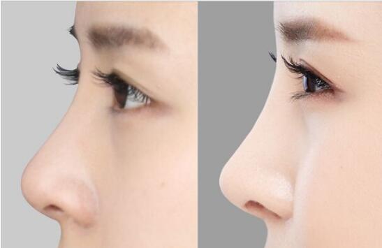 2023年紹興市頂級美容醫(yī)院排行榜：享譽口碑的機構盤點，整形福音收錄！