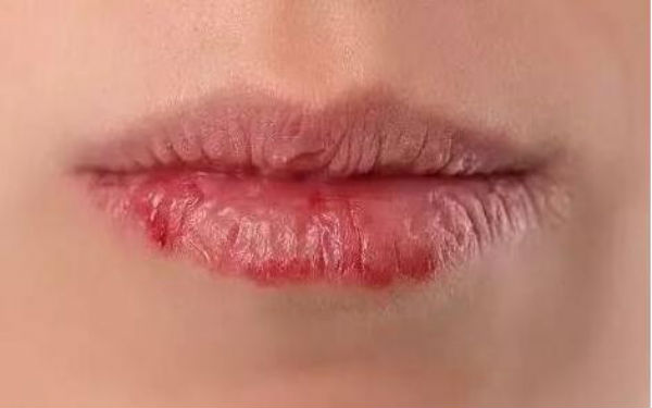 石家莊做眼袋手術醫(yī)生