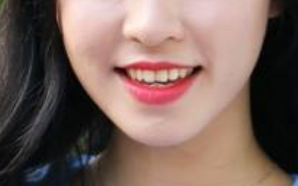 2023年日照洗紋身醫(yī)院評(píng)價(jià)排行榜，你值得信賴的口碑推薦！