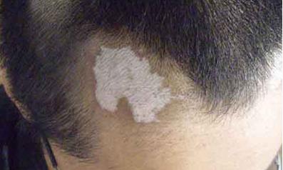 2023年襄陽整形醫(yī)院治療匯總，推薦排名前八，韓寇位列第五，維多利亞穩(wěn)居前三！