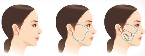 2023年淮安整形醫(yī)院近五年中綜合回顧，美麗殿堂華麗揭幕，蘇王獨領(lǐng)前列！