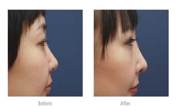 2023年長(zhǎng)沙頂級(jí)整形醫(yī)院盤點(diǎn)：卓越、芳華、華麗居榜單前列！