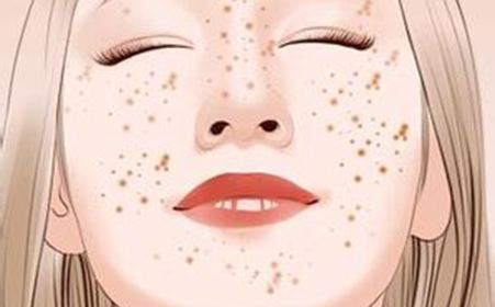 長沙玻尿酸隆胸手術(shù)醫(yī)生