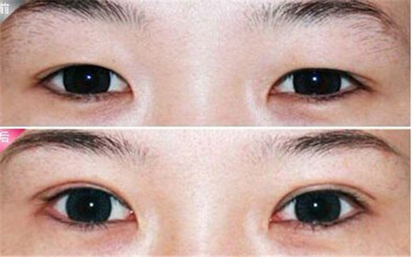 2023年山東治療疤痕的頂尖醫(yī)院評選揭曉！排名前八家機(jī)構(gòu)震撼登場，濟(jì)南、煙臺教你如何選擇