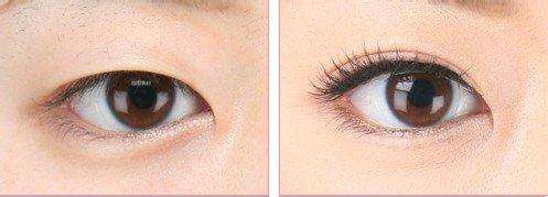 上海專家推薦：首爾麗格、虹橋醫(yī)院為你的祛疤首選！