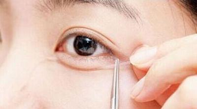 7月五家重慶有名氣的整形醫(yī)院優(yōu)惠價大比拼！整容專家曬出匯總單，誰是冠軍？