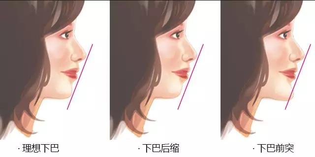 2023濰坊市哪家牙齒矯正醫(yī)院口碑最好？匯總單一鍵自查！