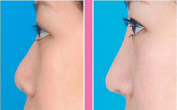 九院醫(yī)生推薦：無論是李青峰還是張余光，都是面部提升領(lǐng)域的頂尖專家！