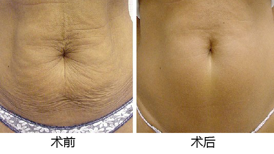 義烏整形醫(yī)院優(yōu)選TOP5，專業(yè)權(quán)威推薦，如何做出準(zhǔn)確選擇？深入了解為上策