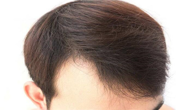 2023長(zhǎng)沙祛斑?？漆t(yī)院排名前八！雅美第二_愛(ài)思特預(yù)約攻略揭秘