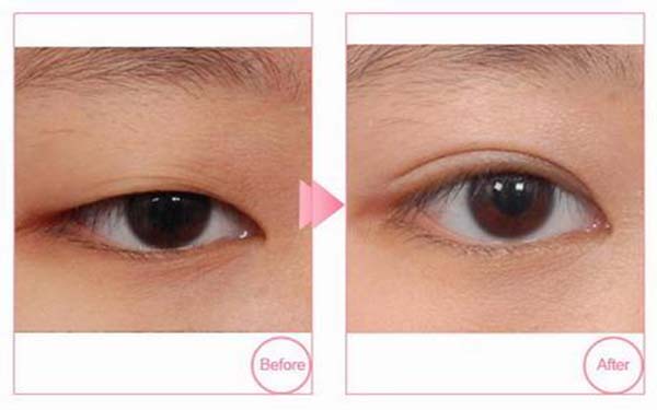 上海五家優(yōu)質(zhì)祛斑美容醫(yī)院盤(pán)點(diǎn)