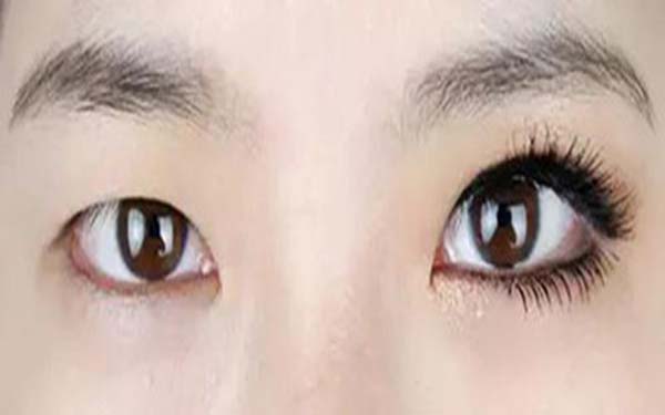 樂(lè)山整形醫(yī)院推薦：達(dá)芬奇與西嬋，你更喜歡哪一個(gè)？獲取比較結(jié)果！