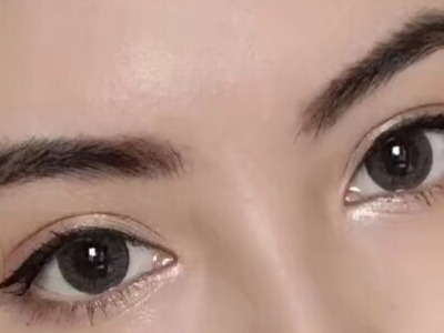 貴陽玻尿酸豐淚溝醫(yī)生