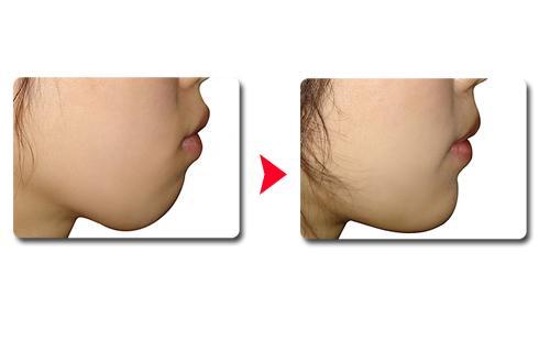 東方美萊塢推出最新臨雙眼皮整形醫(yī)院清單，眾評盛贊其技術(shù)實力！