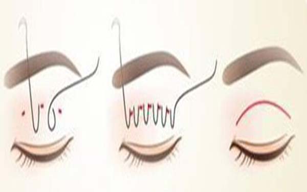 臨沂市七家頂級整形美容醫(yī)院推薦，祛斑護(hù)膚新方法揭秘