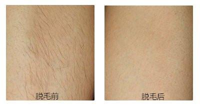 專業(yè)推薦！新疆頂級(jí)眼袋整形醫(yī)生綜合評(píng)價(jià)排行盤點(diǎn)