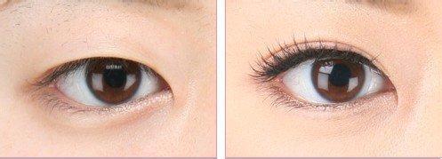 【精選】信陽整形醫(yī)院匯總單超熱門排行榜更新中！輕松掌握易韓、東方藝口碑（技術(shù)）的獨門秘籍