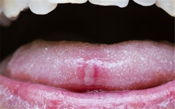 棗莊隆下頜角手術(shù)醫(yī)生