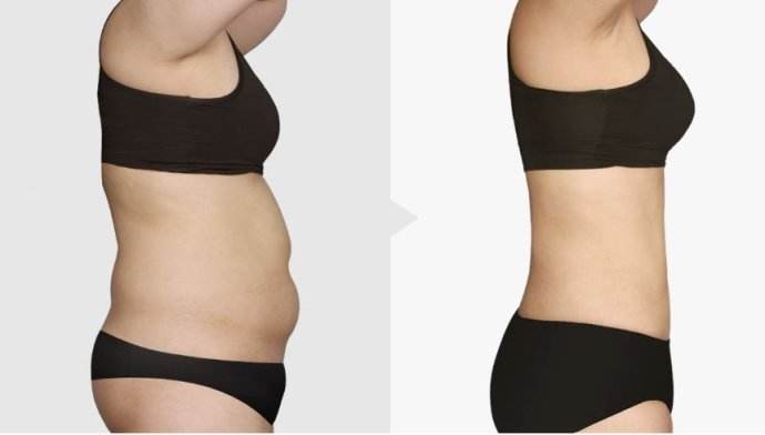 南京激光祛斑?？漆t(yī)院一覽：綜合實力強大，安心選擇！