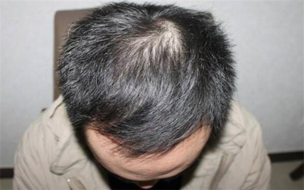 南昌三甲醫(yī)院全面盤點：專業(yè)美容整形醫(yī)院推薦，趕緊了解一下！