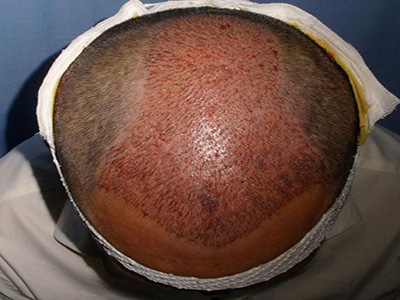 南通最佳祛斑醫(yī)院推薦！康美醫(yī)療第二，維多利亞給力薦！