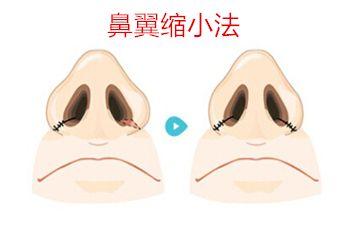 北京十大優(yōu)質(zhì)口腔醫(yī)院推薦，佳美第三醫(yī)院備受贊譽(yù)！中諾榜之精選參考