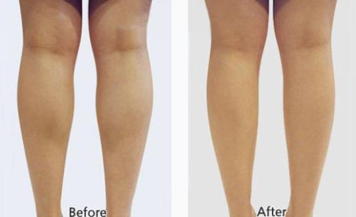 北京整容醫(yī)院評(píng)價(jià)及選擇推薦，專(zhuān)家認(rèn)可度高，口碑可信！