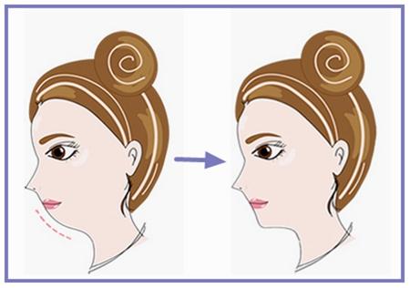 蘭州整形醫(yī)院排行榜出爐！選擇最滿意的吸脂抽脂醫(yī)院！