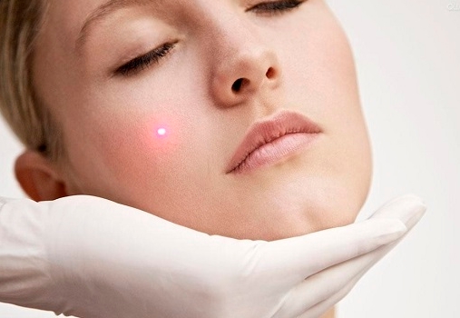 天津切除祛眼睛細(xì)紋醫(yī)生