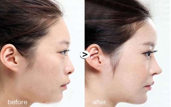 北京眼袋手術(shù)醫(yī)院匯總：前五強(qiáng)推薦，不容錯過！