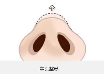 北京植眉醫(yī)院推薦：高新及新生，專業(yè)醫(yī)護(hù)技藝令人贊嘆！