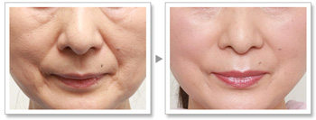 南充皮膚修復(fù)中心：精心挑選的6家洗紋身醫(yī)院，達(dá)芬奇、韓美榜上集結(jié)