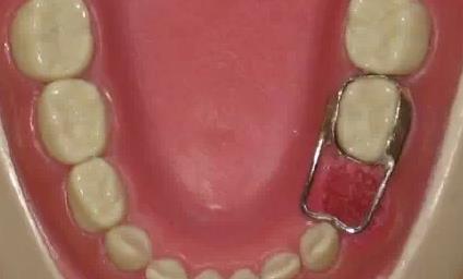 保定整形醫(yī)院雙眼皮割刀痕排行榜揭曉！丨華美、藍山哪家更受保定人喜愛？