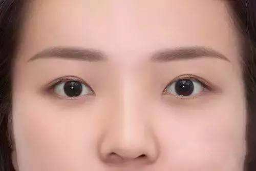 昆明射頻微針去生長紋醫(yī)生