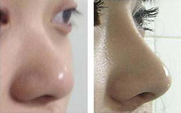 北京頂級整形醫(yī)生盤點：無人不知的9位專業(yè)大咖，技術精湛過人！