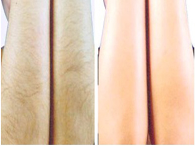 徐州小切口除皺修復(fù)醫(yī)生