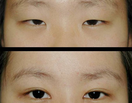 頭五！眼霞醫(yī)美奪魁，藍溪和悅色重要三強，輿論瘋傳！