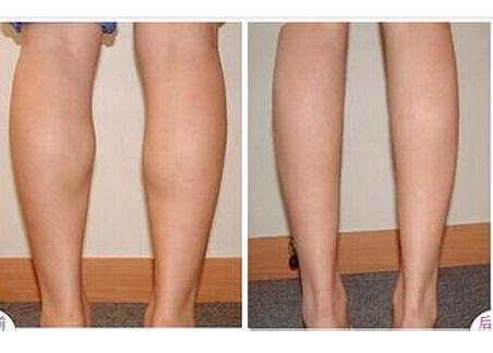 廣州脫發(fā)醫(yī)院排行榜：這些醫(yī)療機構(gòu)讓你恢復美麗發(fā)際線！