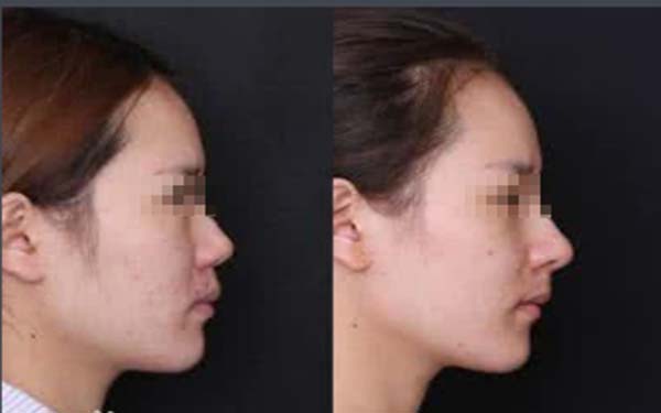 天津美容科醫(yī)院匯總前五，公立機(jī)構(gòu)解決方案公開！